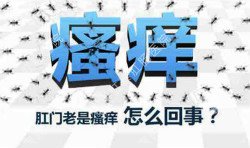 肛門瘙癢治不好嗎？先檢查病因就好辦！